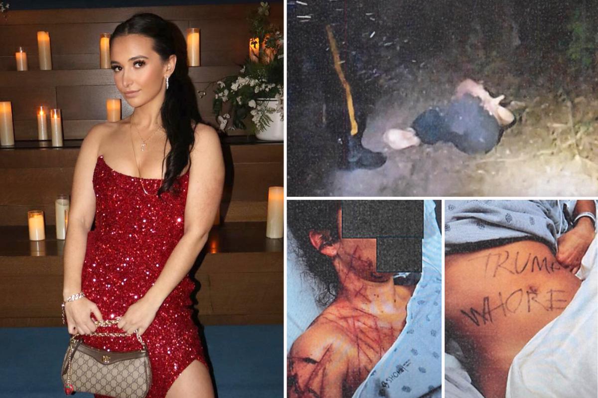 前共和党助理雇恋物癖艺术家自残并伪称遭反特朗普袭击 - 1